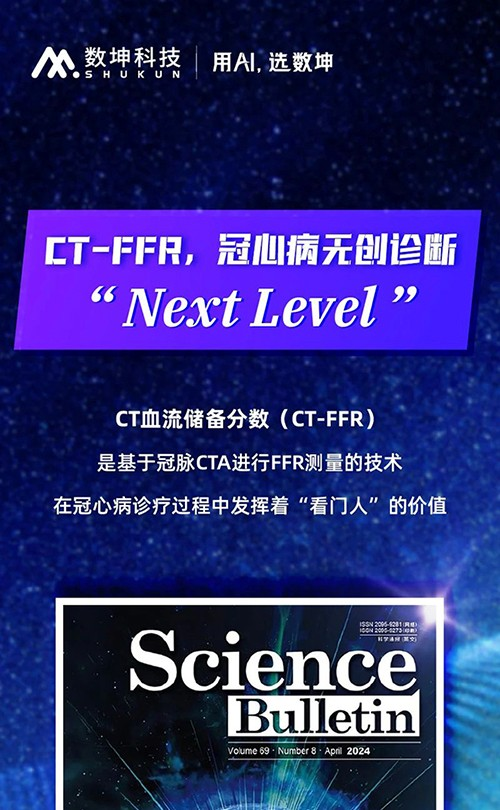 数坤CT-FFR荣登《Science Bulletin》，让冠心病精准诊断再上新台阶